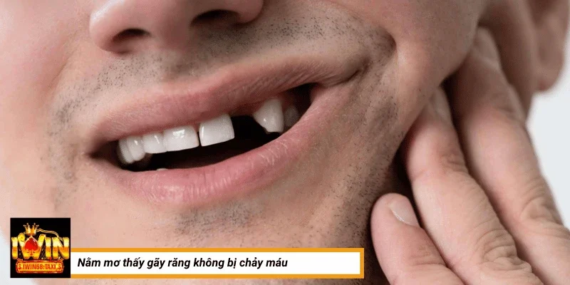 Nằm mơ thấy gãy răng không bị chảy máu